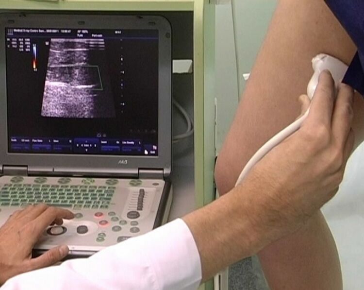ultrazvuková diagnostika kŕčových žíl panvy